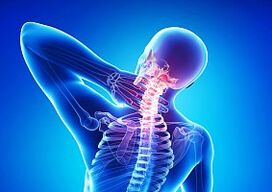 Osteocondrose unha enfermidade da columna vertebral