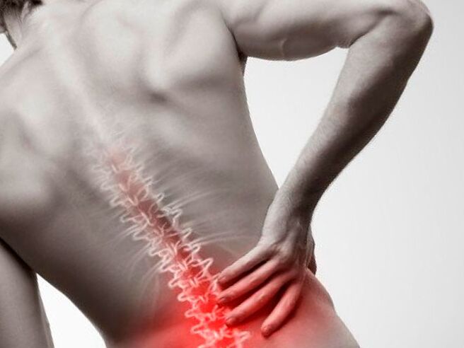 Dor lumbar debido á osteocondrose