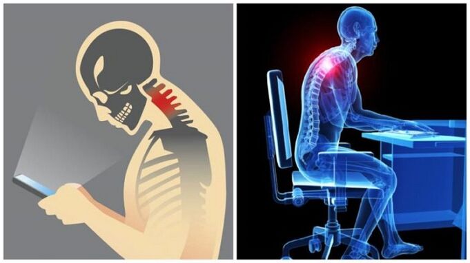 traballo sedentario e inclinación como razóns para o desenvolvemento da osteocondrose