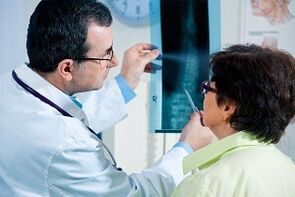 Diagnóstico de raios X de osteocondrose cervical