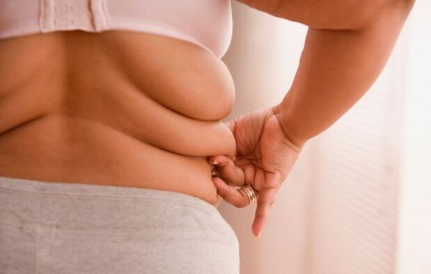 A obesidade, a causa da osteocondrose cervical en mulleres menores de 40 anos